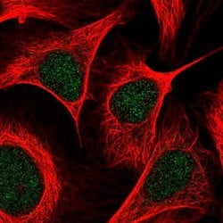 Invitrogen PCAF Polyclonal Antibody 100 &mu;L; Unconjugated:Antibodies,