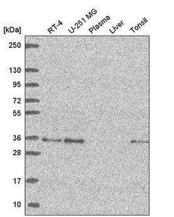 Invitrogen GOLPH3 Polyclonal Antibody 100 &mu;L; Unconjugated:Antibodies,