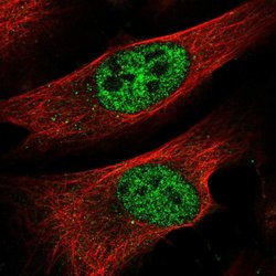 BTBD11 Rabbit anti-Human, Polyclonal, Invitrogen 100 &mu;L; Unconjugated:Antibodies,