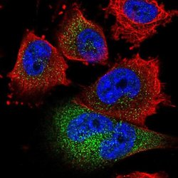 Invitrogen GOLT1B Polyclonal Antibody 100 &mu;L; Unconjugated:Antibodies,