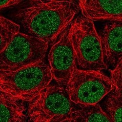 Invitrogen CHTF18 Polyclonal Antibody 100 &mu;L; Unconjugated:Antibodies,