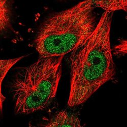Invitrogen NUP37 Polyclonal Antibody 100 μL; Unconjugated:Antibodies,