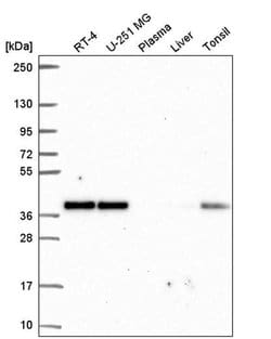 Invitrogen NUP37 Polyclonal Antibody 100 μL; Unconjugated:Antibodies,