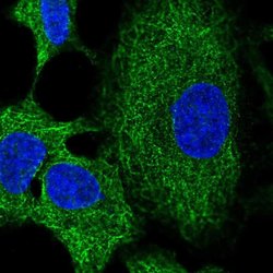 Invitrogen RNF215 Polyclonal Antibody 100 &mu;L; Unconjugated:Antibodies,
