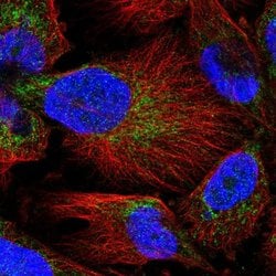Invitrogen MARCH5 Polyclonal Antibody 100 &mu;L; Unconjugated:Antibodies,