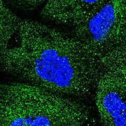 Invitrogen COQ2 Polyclonal Antibody 100 &mu;L; Unconjugated:Antibodies,