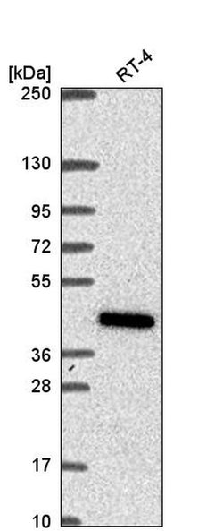 Invitrogen COQ2 Polyclonal Antibody 100 &mu;L; Unconjugated:Antibodies,