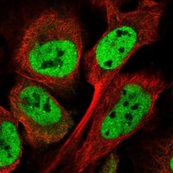 Invitrogen ATXN7L3B Polyclonal Antibody 100 &mu;L; Unconjugated:Antibodies,