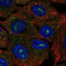 Invitrogen CACNG6 Polyclonal Antibody 100 &mu;L; Unconjugated:Antibodies,