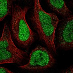 Invitrogen GTF2IRD2B Polyclonal Antibody 100 &mu;L; Unconjugated:Antibodies,