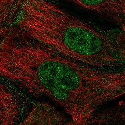 Invitrogen ZGPAT Polyclonal Antibody 100 &mu;L; Unconjugated:Antibodies,