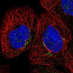 CYBRD1 Polyclonal Antibody:Antibodies, Polyclonal