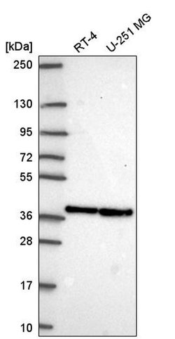 Invitrogen ARGLU1 Polyclonal Antibody 100 &mu;L; Unconjugated:Antibodies,