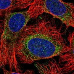 RHBDD1 Polyclonal Antibody, Invitrogen 100 &mu;L; Unconjugated:Antibodies,