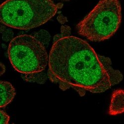 Invitrogen KCNN3 Polyclonal Antibody 100 &mu;L; Unconjugated:Antibodies,
