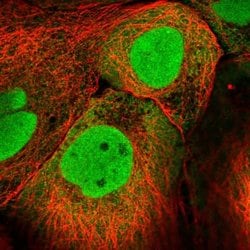 Invitrogen PKNOX1 Polyclonal Antibody 100 &mu;L; Unconjugated:Antibodies,