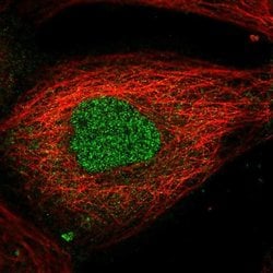 Invitrogen AMMECR1L Polyclonal Antibody 100 &mu;L; Unconjugated:Antibodies,