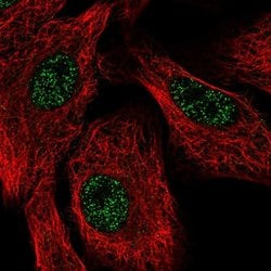 SETX Polyclonal Antibody:Antibodies, Polyclonal