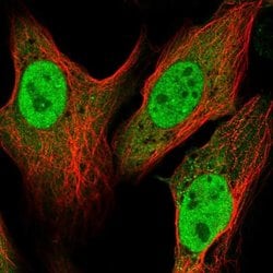 Invitrogen V-ATPase C1 Polyclonal Antibody 100 &mu;L; Unconjugated:Antibodies,