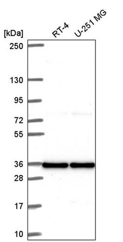 Invitrogen V-ATPase C1 Polyclonal Antibody 100 &mu;L; Unconjugated:Antibodies,