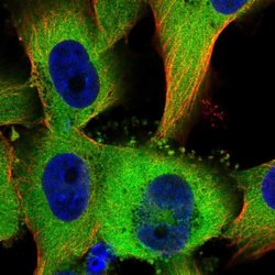 Invitrogen TTC1 Polyclonal Antibody 100 &mu;L; Unconjugated:Antibodies,