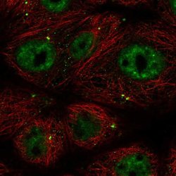 Invitrogen CCDC92 Polyclonal Antibody 100 &mu;L; Unconjugated:Antibodies,