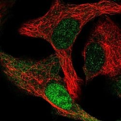 Invitrogen CDK2AP1 Polyclonal Antibody 100 &mu;L; Unconjugated:Antibodies,
