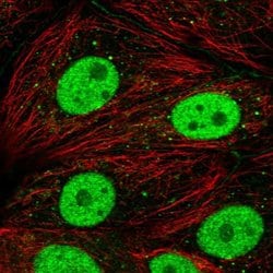Invitrogen DCP2 Polyclonal Antibody 100 &mu;L; Unconjugated:Antibodies,
