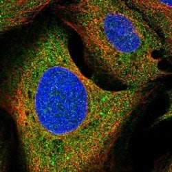 Invitrogen Growth Hormone Receptor Polyclonal Antibody 100 &mu;L; Unconjugated:Antibodies,