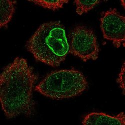 RAMP1 Rabbit anti-Human, Polyclonal, Invitrogen 100 &mu;L; Unconjugated:Antibodies,