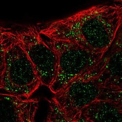 Carbonic Anhydrase X Polyclonal Antibody:Antibodies, Polyclonal