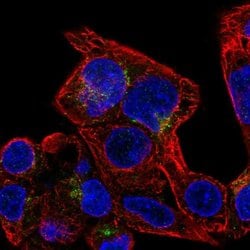 SLC29A3 Polyclonal Antibody, Invitrogen 100 &mu;L; Unconjugated:Antibodies,