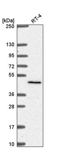 SLC29A3 Polyclonal Antibody, Invitrogen 100 &mu;L; Unconjugated:Antibodies,