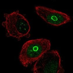 Invitrogen SLC10A7 Polyclonal Antibody 100 &mu;L; Unconjugated:Antibodies,