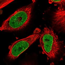 NSUN3 Polyclonal Antibody:Antibodies, Polyclonal