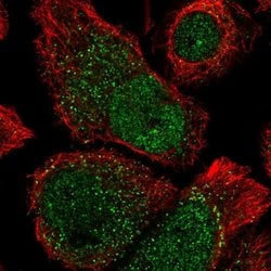 Invitrogen ANKRD37 Polyclonal Antibody 100 &mu;L; Unconjugated:Antibodies,