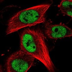 Invitrogen RBM15B Polyclonal Antibody 100 &mu;L; Unconjugated:Antibodies,