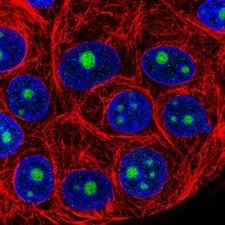 Invitrogen NOP16 Polyclonal Antibody 100 &mu;L | Buy Online | Invitrogen&trade; | Fisher Scientific