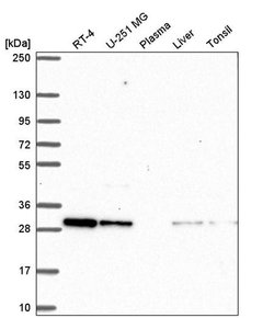 Invitrogen CXXC5 Polyclonal Antibody 100 &mu;L; Unconjugated:Antibodies,