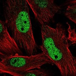 Invitrogen EMP Polyclonal Antibody 100 &mu;L; Unconjugated:Antibodies,