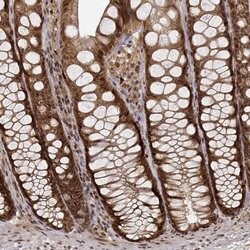 Invitrogen EMP Polyclonal Antibody 100 &mu;L; Unconjugated:Antibodies,