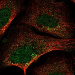 Invitrogen SLA2 Polyclonal Antibody 100 &mu;L; Unconjugated:Antibodies,