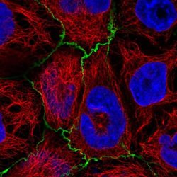 Invitrogen PLEKHG6 Polyclonal Antibody 100 &mu;L; Unconjugated:Antibodies,