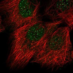 Invitrogen CENPC Polyclonal Antibody 100 &mu;L; Unconjugated:Antibodies,
