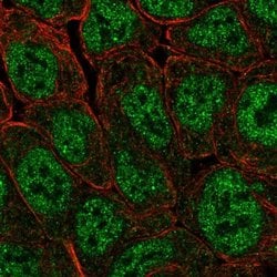 Invitrogen POU5F1B Polyclonal Antibody 100 &mu;L; Unconjugated:Antibodies,