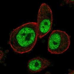 Invitrogen MAPKAPK3 Polyclonal Antibody 100 &mu;L; Unconjugated:Antibodies,