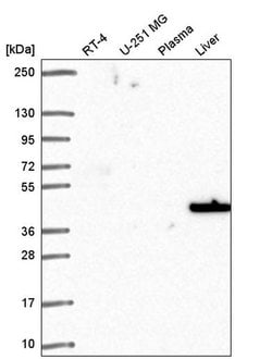 SLC14A1 Polyclonal Antibody, Invitrogen&trade; 100 &mu;L; Unconjugated 