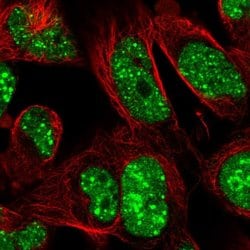 Invitrogen RNF169 Polyclonal Antibody 100 &mu;L; Unconjugated:Antibodies,