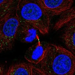 Invitrogen ADAMTS19 Polyclonal Antibody 100 &mu;L; Unconjugated:Antibodies,