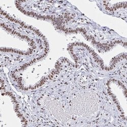 Invitrogen UAP56 Polyclonal Antibody 100 &mu;L; Unconjugated:Antibodies,